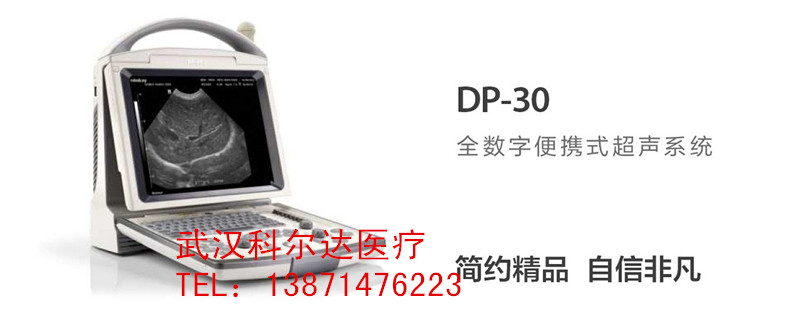 迈瑞DP-30全数字便携式超声诊断系统