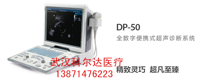 迈瑞DP-50全数字便携式超声诊断仪