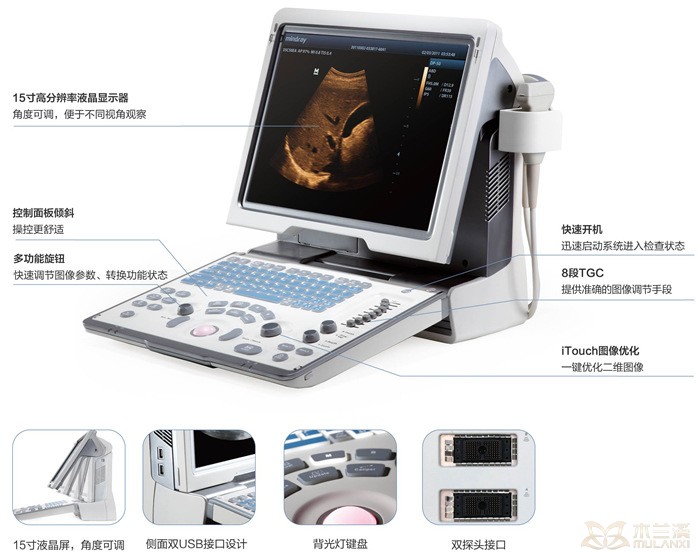 迈瑞DP-50全数字便携式超声诊断仪