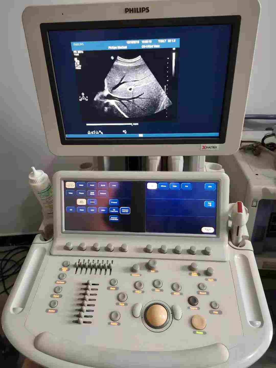 飞利浦彩超维修  飞利浦BHD11XE报错故障维修