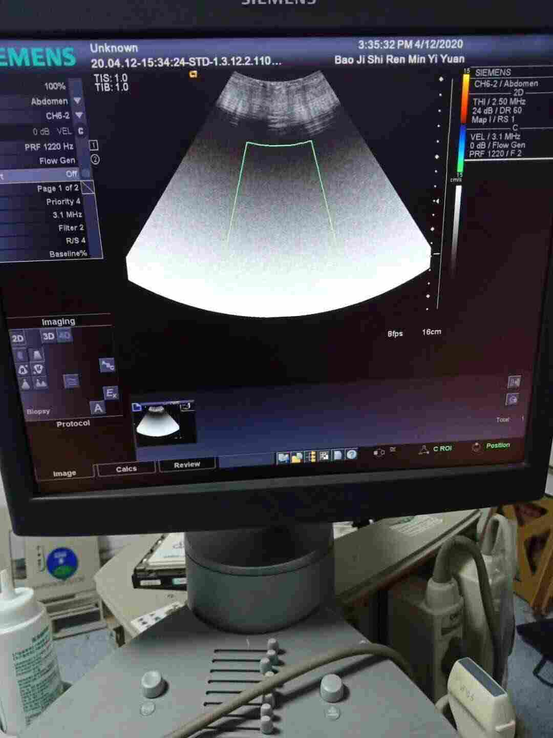 飞利浦彩超维修维保服务,主板维修交换