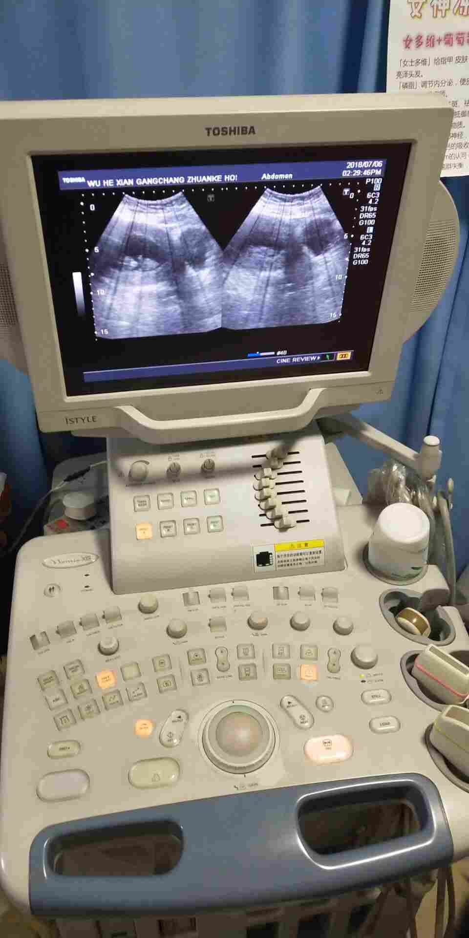 东芝SSA-660A彩超维修 东芝彩超配件更换