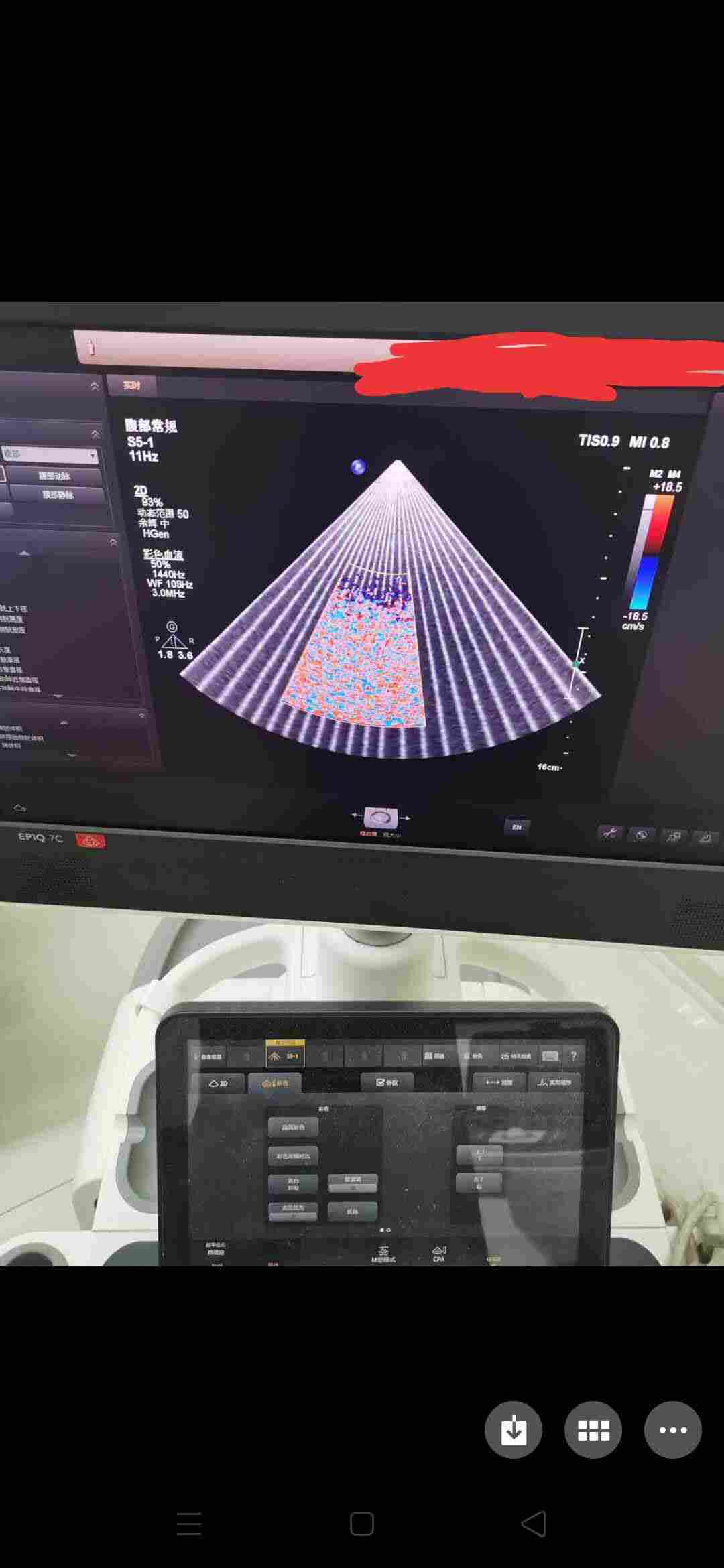 飞利浦彩超EPIQ5雪花状问题维修