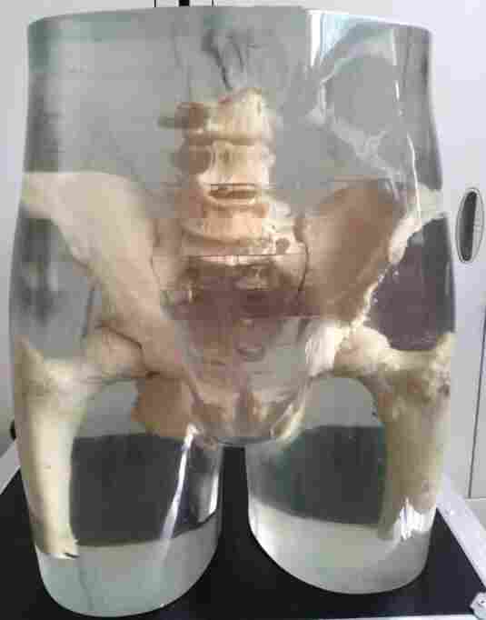 X射線髖關(guān)節(jié)模體-真人骨頭X射線髖關(guān)節(jié)模體產(chǎn)品圖片