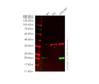 重组Anti-Ferritin抗体 EPR3004Y   ab75973